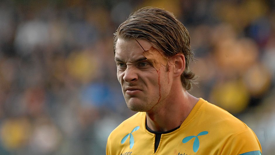 Espen Børufsen blør for drakta